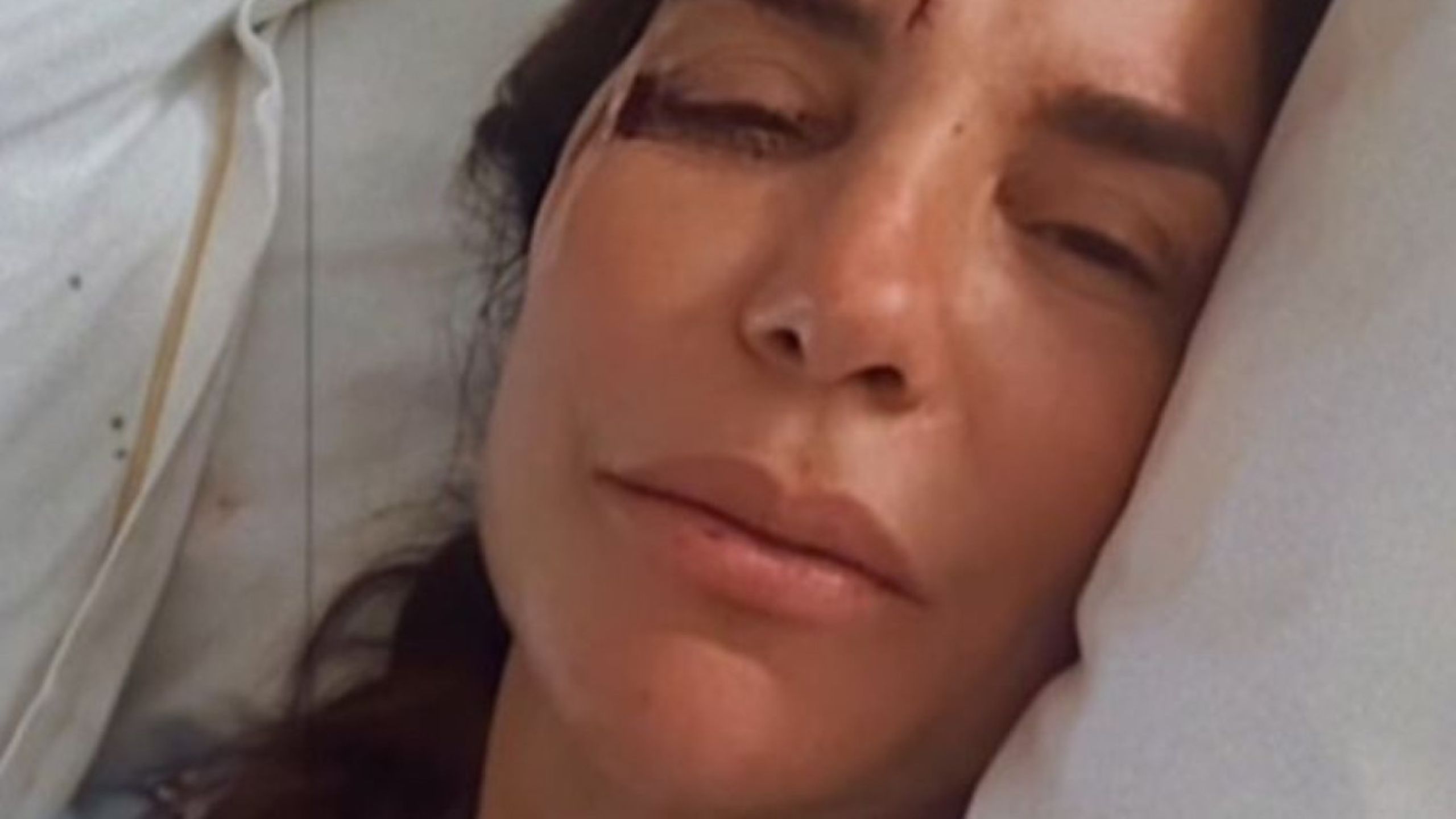 Ivete Sangalo passa por cirurgia; saiba o estado de saúde