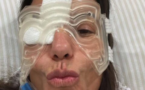 Imagem do post Ivete Sangalo desabafa sobre inchaço e hematoma no rosto