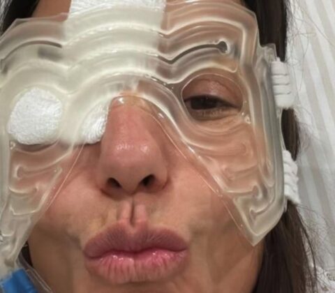 Imagem do post Ivete Sangalo desabafa sobre inchaço e hematoma no rosto