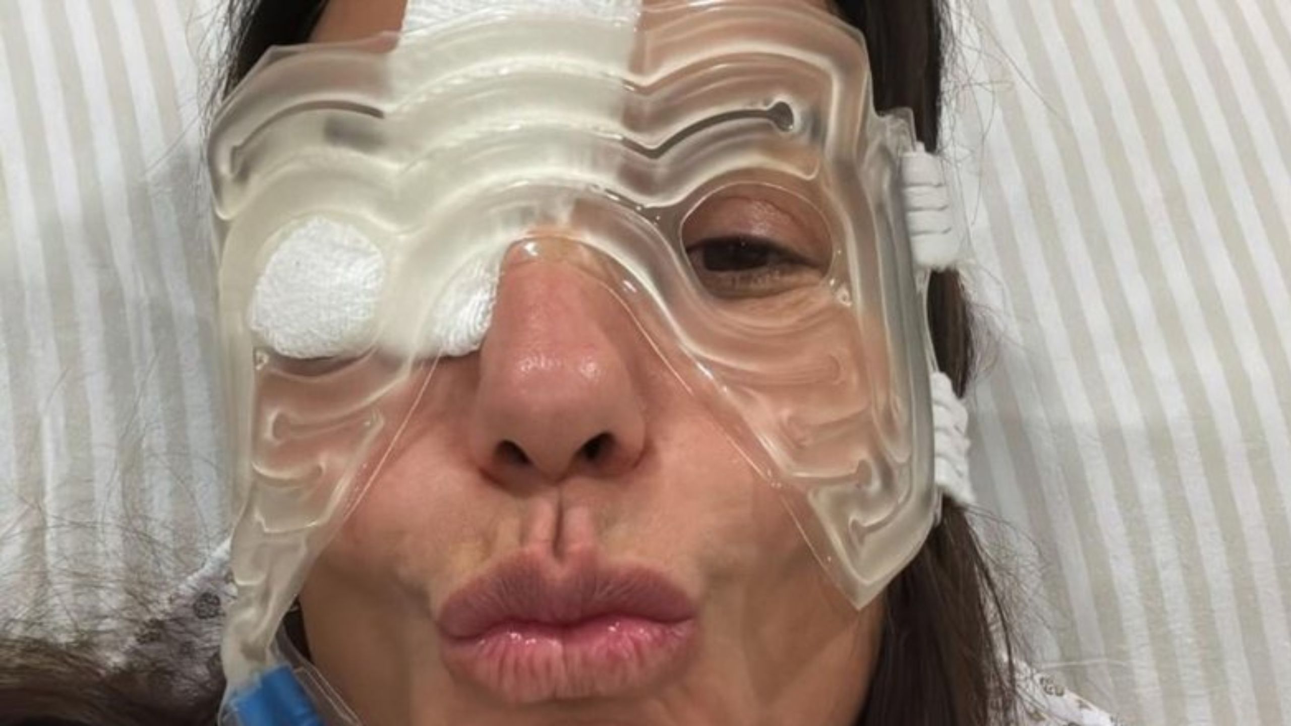 Ivete Sangalo desabafa sobre inchaço e hematoma no rosto