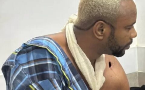 Imagem do post Líder do CV é preso após dar entrada baleado em clínica de Salvador