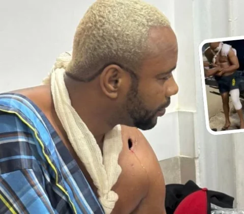 Imagem do post “Xandy” do CV: Traficante preso em hospital é suspeito participação no homicídio do cabo da PM Glauber