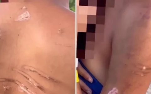 Imagem do post Adolescente é sequestrada e torturada por facção com mangueira de gás