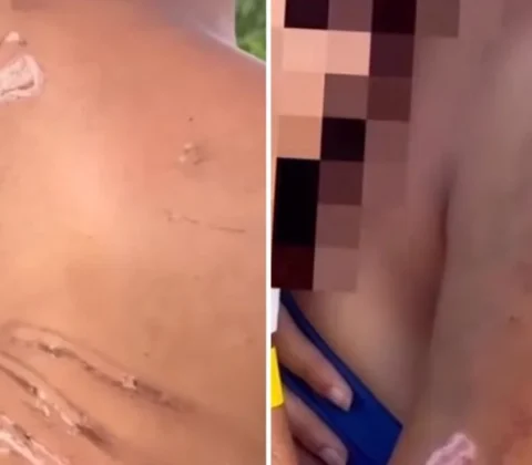 Imagem do post Adolescente é sequestrada e torturada por facção com mangueira de gás