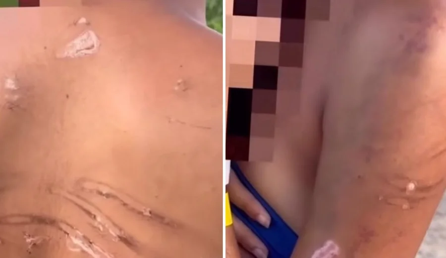 Adolescente é sequestrada e torturada por facção com mangueira de gás