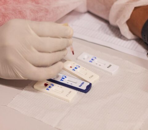Imagem do post ISTs no São João: Bahia registra mais de 100 casos positivos em testagen