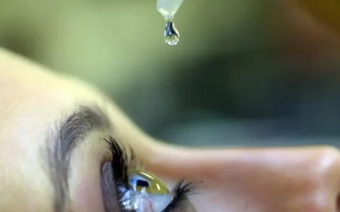 Imagem do post Uso sem receita de corticoides preocupa médicos e aumenta risco de cegueira