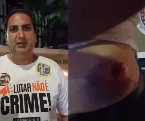 Imagem do post Candidato ao Governo da Bahia é atingido por bala de borracha durante protesto na Paralela