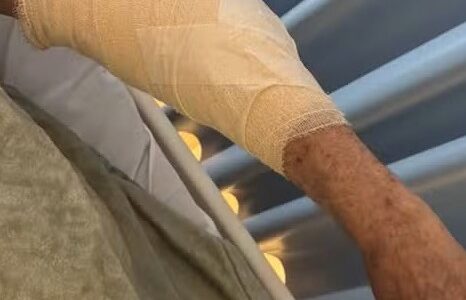 Imagem do post Idoso é atacado por pitbull em Stella Maris; ferimento exigiu cirurgia