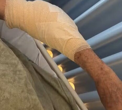 Imagem do post Idoso é atacado por pitbull em Stella Maris; ferimento exigiu cirurgia